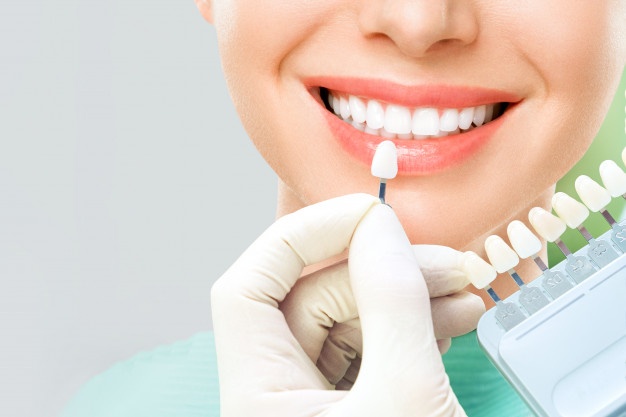 CROWNS AND VENEERS (Same day)